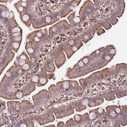 Invitrogen GAS2L3 Polyclonal Antibody 100 &mu;L | Buy Online | Invitrogen&trade; | Fisher Scientific