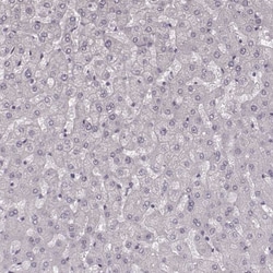 Invitrogen KRT74 Polyclonal Antibody 100 &mu;L; Unconjugated:Antibodies,