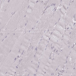 Invitrogen KRT74 Polyclonal Antibody 100 &mu;L; Unconjugated:Antibodies,