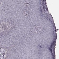 Invitrogen KRT74 Polyclonal Antibody 100 &mu;L; Unconjugated:Antibodies,