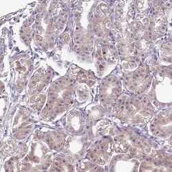 IGIP Polyclonal Antibody:Antibodies, Polyclonal