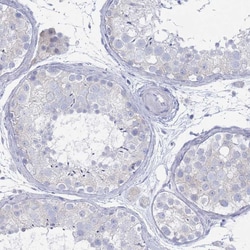 Invitrogen MAT1A Polyclonal Antibody 100 &mu;L; Unconjugated:Antibodies,