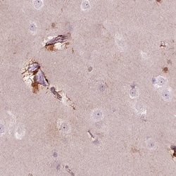 Invitrogen KCNG2 Polyclonal Antibody 100 &mu;L; Unconjugated:Antibodies,