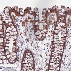 Invitrogen PPP1R27 Polyclonal Antibody 100 &mu;L; Unconjugated:Antibodies,