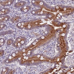 Invitrogen TMC4 Polyclonal Antibody 100 &mu;L; Unconjugated:Antibodies,