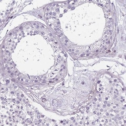 Invitrogen TMC4 Polyclonal Antibody 100 &mu;L; Unconjugated:Antibodies,