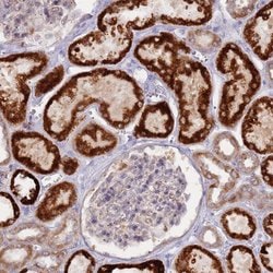 Invitrogen LDHD Polyclonal Antibody 100 &mu;L; Unconjugated:Antibodies,