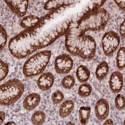 Invitrogen LDHD Polyclonal Antibody 100 &mu;L; Unconjugated:Antibodies,