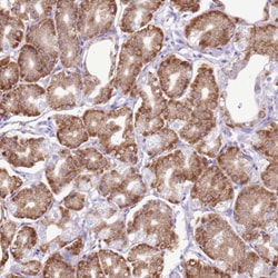 Invitrogen AAR2 Polyclonal Antibody 100 &mu;L; Unconjugated:Antibodies,