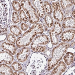 Invitrogen CBX7 Polyclonal Antibody 100 &mu;L; Unconjugated:Antibodies,