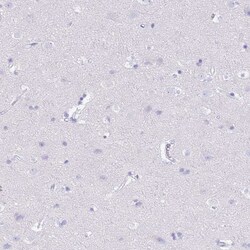 Invitrogen Acrosin Polyclonal Antibody 100 &mu;L; Unconjugated:Antibodies,