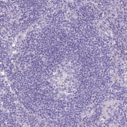 Invitrogen Acrosin Polyclonal Antibody 100 &mu;L; Unconjugated:Antibodies,