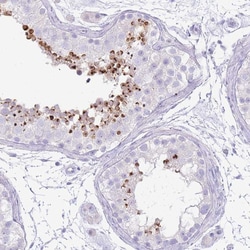 Invitrogen Acrosin Polyclonal Antibody 100 &mu;L; Unconjugated:Antibodies,