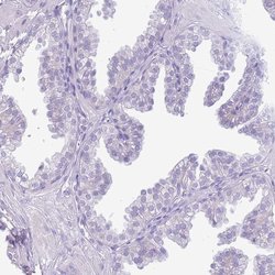 Invitrogen Acrosin Polyclonal Antibody 100 &mu;L; Unconjugated:Antibodies,