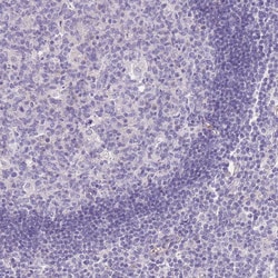 Invitrogen TINAGL1 Polyclonal Antibody 100 &mu;L; Unconjugated:Antibodies,