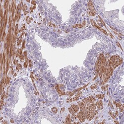 Invitrogen TINAGL1 Polyclonal Antibody 100 &mu;L; Unconjugated:Antibodies,