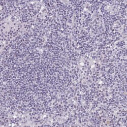 Invitrogen RFX1 Polyclonal Antibody 100 &mu;L | Buy Online | Invitrogen&trade; | Fisher Scientific