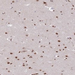 Invitrogen RFX1 Polyclonal Antibody 100 &mu;L | Buy Online | Invitrogen&trade; | Fisher Scientific