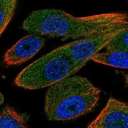 Invitrogen RNF31 Polyclonal Antibody 100 &mu;L; Unconjugated:Antibodies,