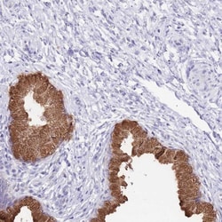 Invitrogen OR2Z1 Polyclonal Antibody 100 &mu;L; Unconjugated:Antibodies,
