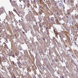 Invitrogen TMEM178B Polyclonal Antibody 100 &mu;L | Buy Online | Invitrogen&trade; | Fisher Scientific