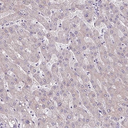 Invitrogen TMEM178B Polyclonal Antibody 100 &mu;L | Buy Online | Invitrogen&trade; | Fisher Scientific