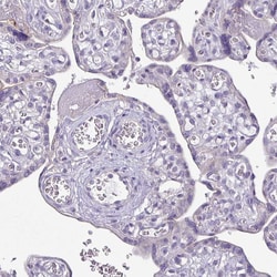 Invitrogen TMEM178B Polyclonal Antibody 100 &mu;L | Buy Online | Invitrogen&trade; | Fisher Scientific