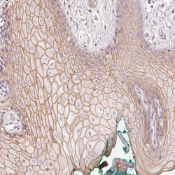 Invitrogen p53AIP1 Polyclonal Antibody 100 &mu;L; Unconjugated:Antibodies,