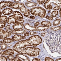 Invitrogen CIT Polyclonal Antibody 100 &mu;L; Unconjugated:Antibodies,
