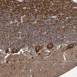 KRTAP27-1 Polyclonal Antibody:Antibodies, Polyclonal