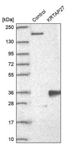 KRTAP27-1 Polyclonal Antibody:Antibodies, Polyclonal