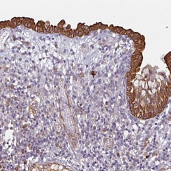 Invitrogen CEP78 Polyclonal Antibody 100 &mu;L; Unconjugated:Antibodies,