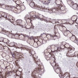Invitrogen DHX32 Polyclonal Antibody 100 &mu;L; Unconjugated:Antibodies,