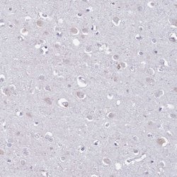 Invitrogen LTB Polyclonal Antibody 100 &mu;L; Unconjugated:Antibodies,
