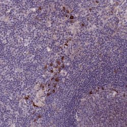Invitrogen LTB Polyclonal Antibody 100 &mu;L; Unconjugated:Antibodies,