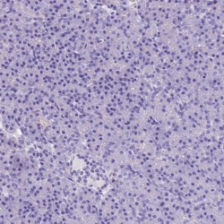 Invitrogen TBC1D10B Polyclonal Antibody 100 &mu;L; Unconjugated:Antibodies,