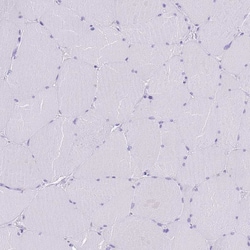 Invitrogen TBC1D10B Polyclonal Antibody 100 &mu;L; Unconjugated:Antibodies,