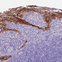 Invitrogen TBC1D10B Polyclonal Antibody 100 &mu;L; Unconjugated:Antibodies,
