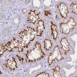 Invitrogen CHSY1 Polyclonal Antibody 100 &mu;L; Unconjugated:Antibodies,