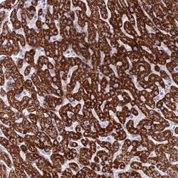 Invitrogen RNF222 Polyclonal Antibody 100 &mu;L; Unconjugated:Antibodies,