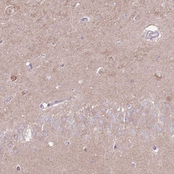 Invitrogen LRFN3 Polyclonal Antibody 100 &mu;L; Unconjugated:Antibodies,