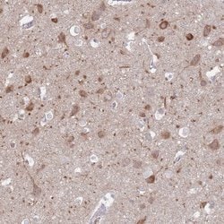 Invitrogen FAM69C Polyclonal Antibody 100 &mu;L; Unconjugated:Antibodies,