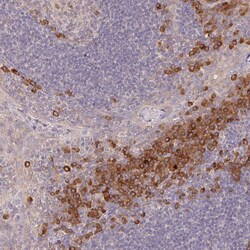Invitrogen DERL2 Polyclonal Antibody 100 &mu;L; Unconjugated:Antibodies,