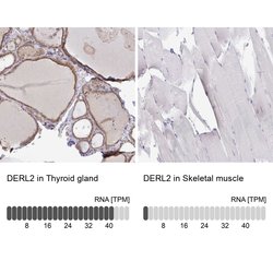Invitrogen DERL2 Polyclonal Antibody 100 &mu;L; Unconjugated:Antibodies,
