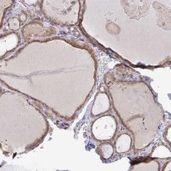 Invitrogen DERL2 Polyclonal Antibody 100 &mu;L; Unconjugated:Antibodies,