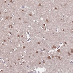 Invitrogen TFAP2D Polyclonal Antibody 100 &mu;L; Unconjugated:Antibodies,