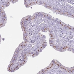 Invitrogen RFX2 Polyclonal Antibody 100 &mu;L; Unconjugated:Antibodies,