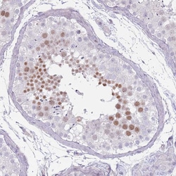 Invitrogen RFX2 Polyclonal Antibody 100 &mu;L; Unconjugated:Antibodies,