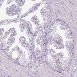 Invitrogen RFX2 Polyclonal Antibody 100 &mu;L; Unconjugated:Antibodies,
