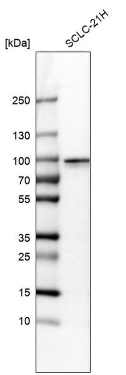 Invitrogen RFX2 Polyclonal Antibody 100 &mu;L; Unconjugated:Antibodies,